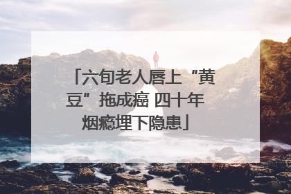六旬老人唇上“黄豆”拖成癌 四十年烟瘾埋下隐患
